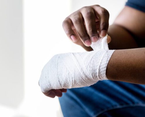 image of injured wrist for personal injury claims at Mullins & Treacy LLP Solicitors